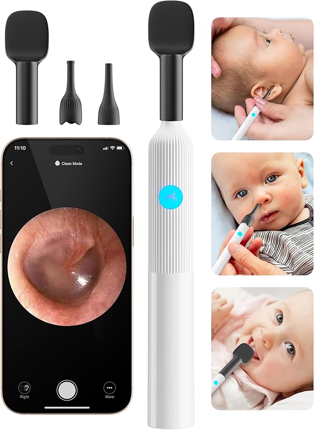 OTTOLIVES Baby Ear, Nose, Throat Examination Set with HD Camera, Home ENT Scope with 6LED Light, Ear Checker Tool, Baby Healthcare and Grooming Kit, Registry Essential Kit