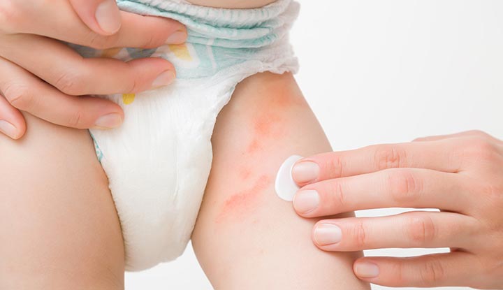 Gentle-baby-diaper-cream-for-rash-prevention-and-skin-protection–LittleNest-Shop