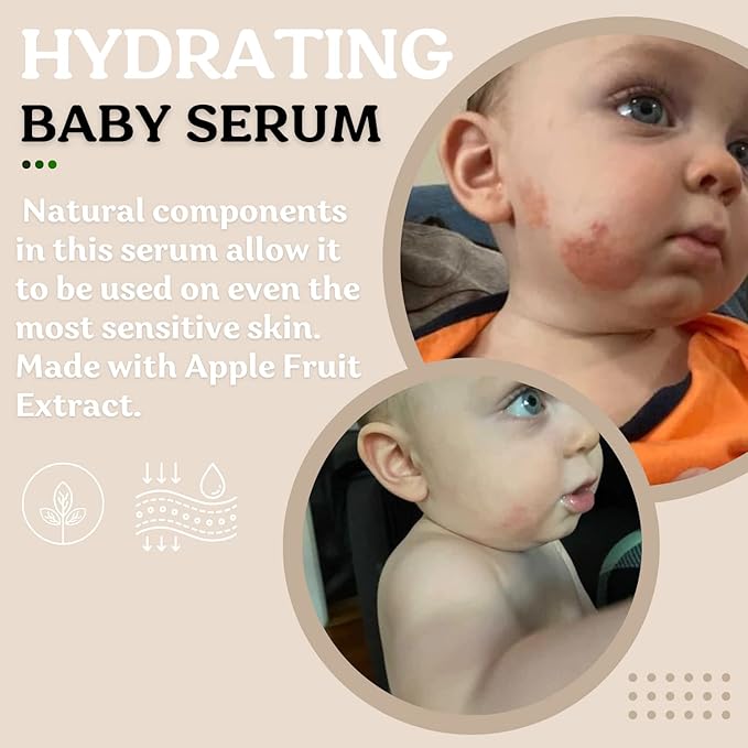 Roe Wellness- Baby Serum Skincare Probiotic Protection | Hydrating, Soothing