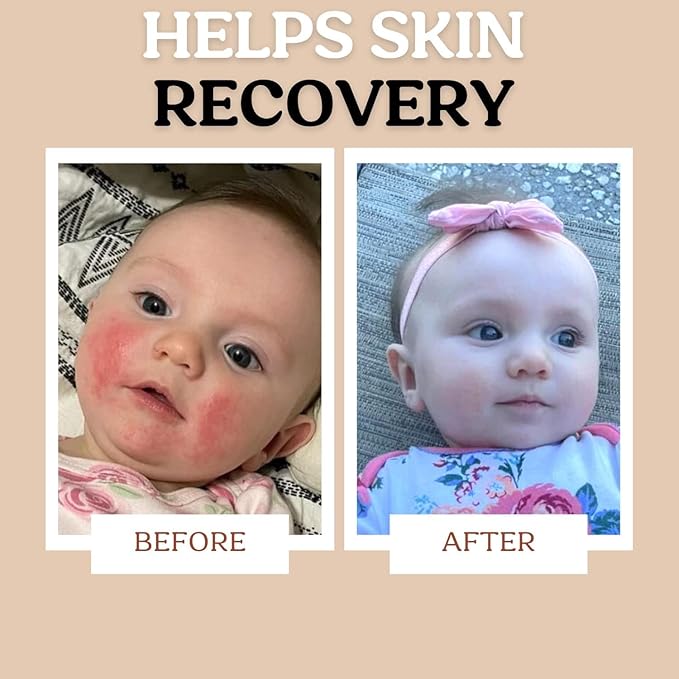 Power Pair Probiotic Baby Power Serum & Biome Barrier Cream | Hydrating, Soothing